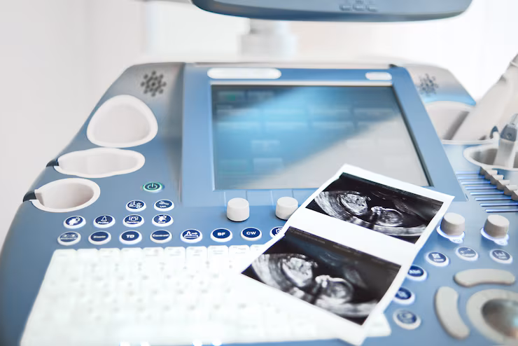 3D/4D Sonography